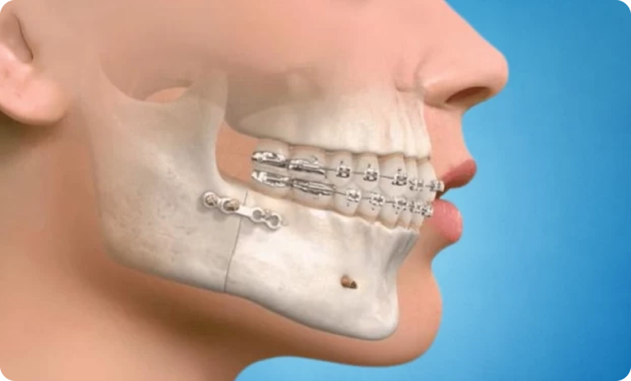 Oral and Maxillofacial Surgery