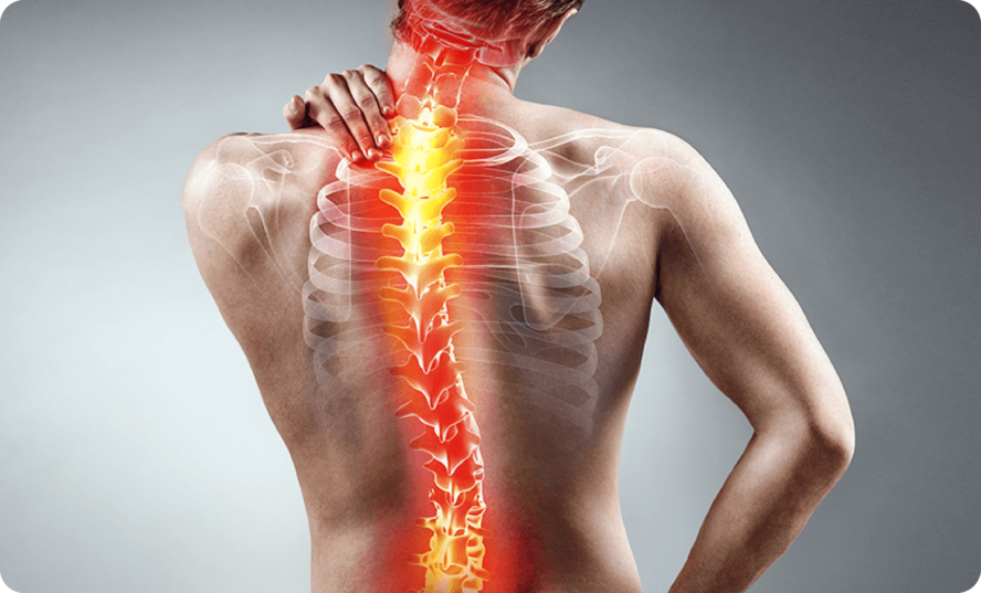 Spine and Scoliosis Correction