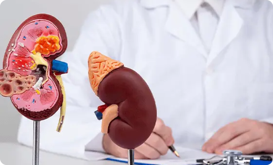 Kidney Transplant
