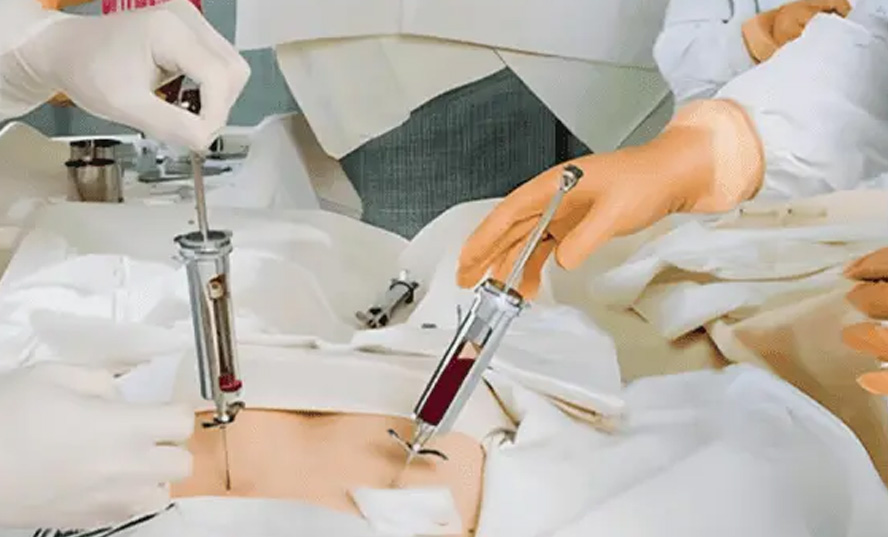 Bone Marrow Transplantation 