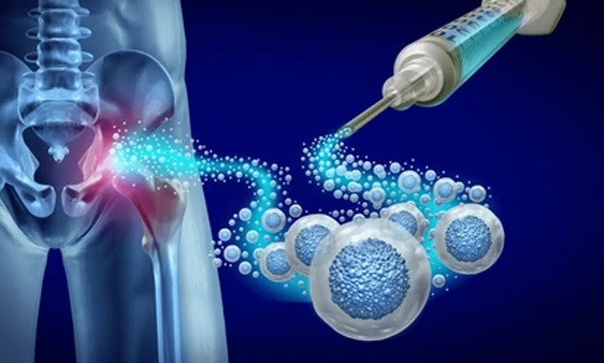 Trustwell Hospitals - Bone Marrow Transplantation