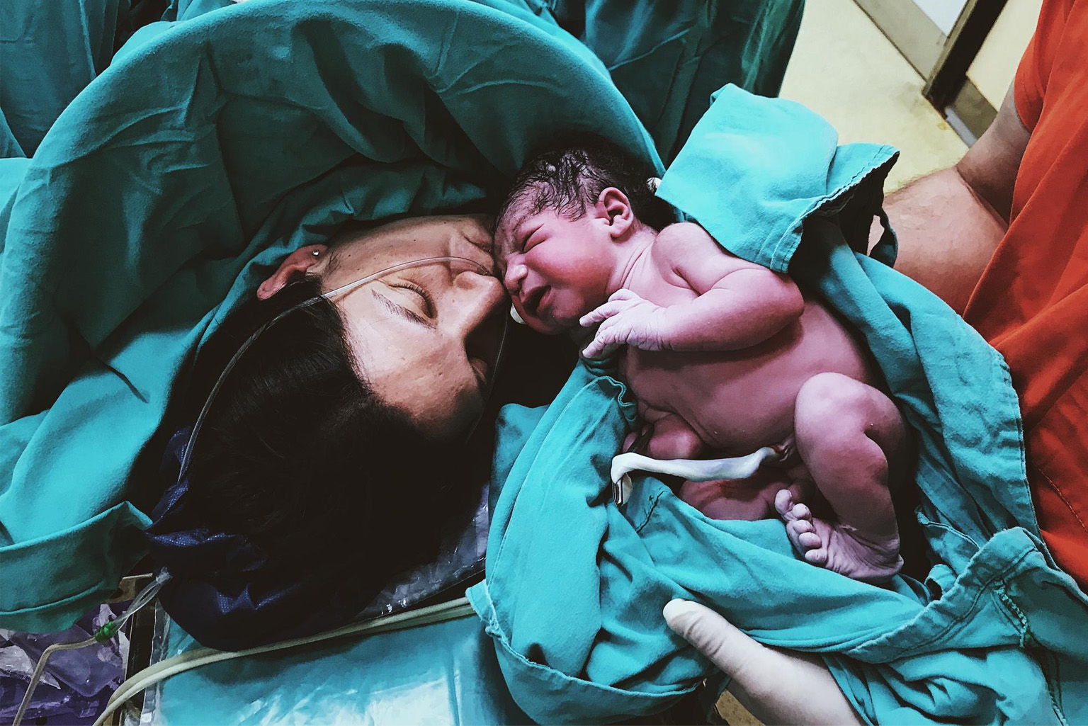 Natural Birthing vs. Cesarean Section: Honouring Motherhood’s Journey
