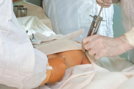 Bone Marrow Transplant (BMT): A Patient-Friendly FAQ Guide