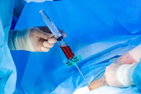 Understanding Bone Marrow Transplant: Advanced Cancer Care Begins with the Right Expertise