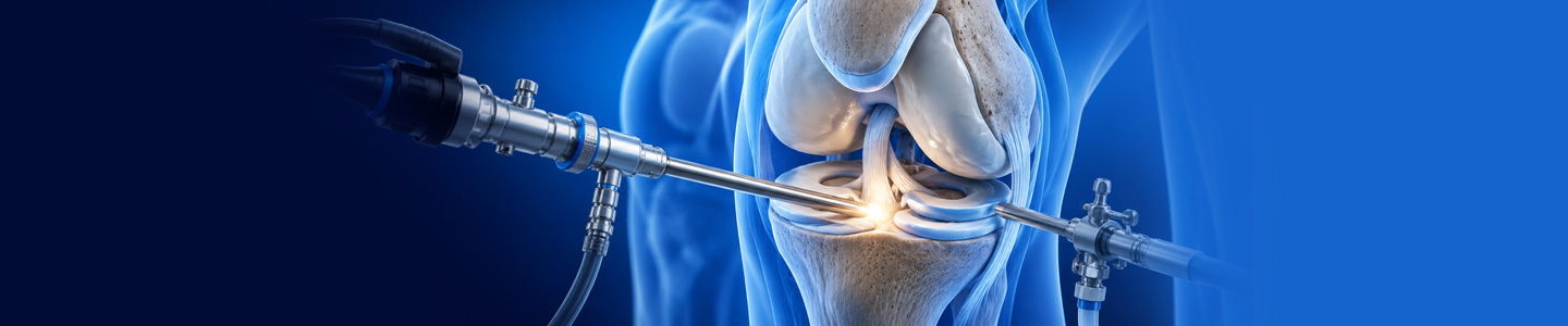 Arthroscopy Surgery in Bangalore | Trustwell Hospital
