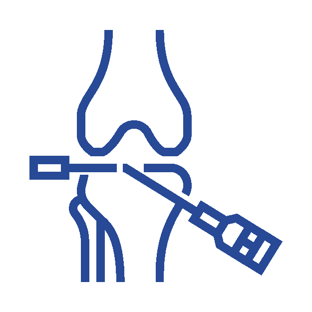 Arthroscopy Surgery