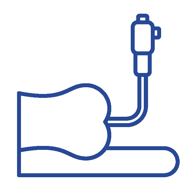 Colonoscopy