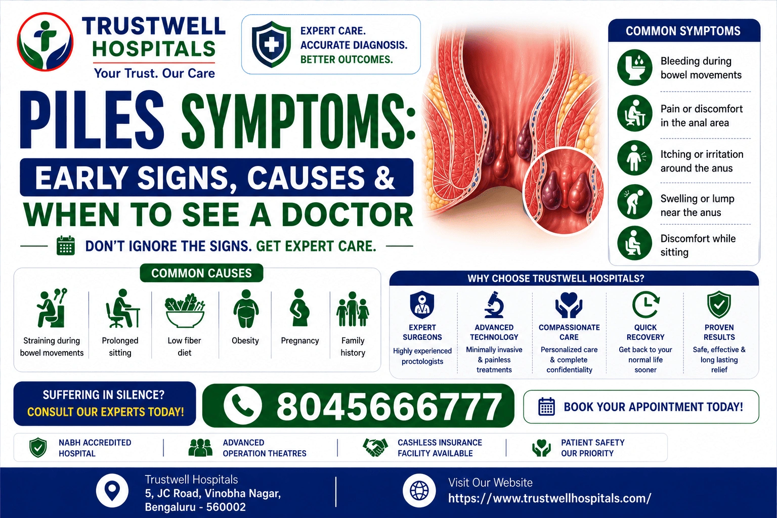 Piles Symptoms
