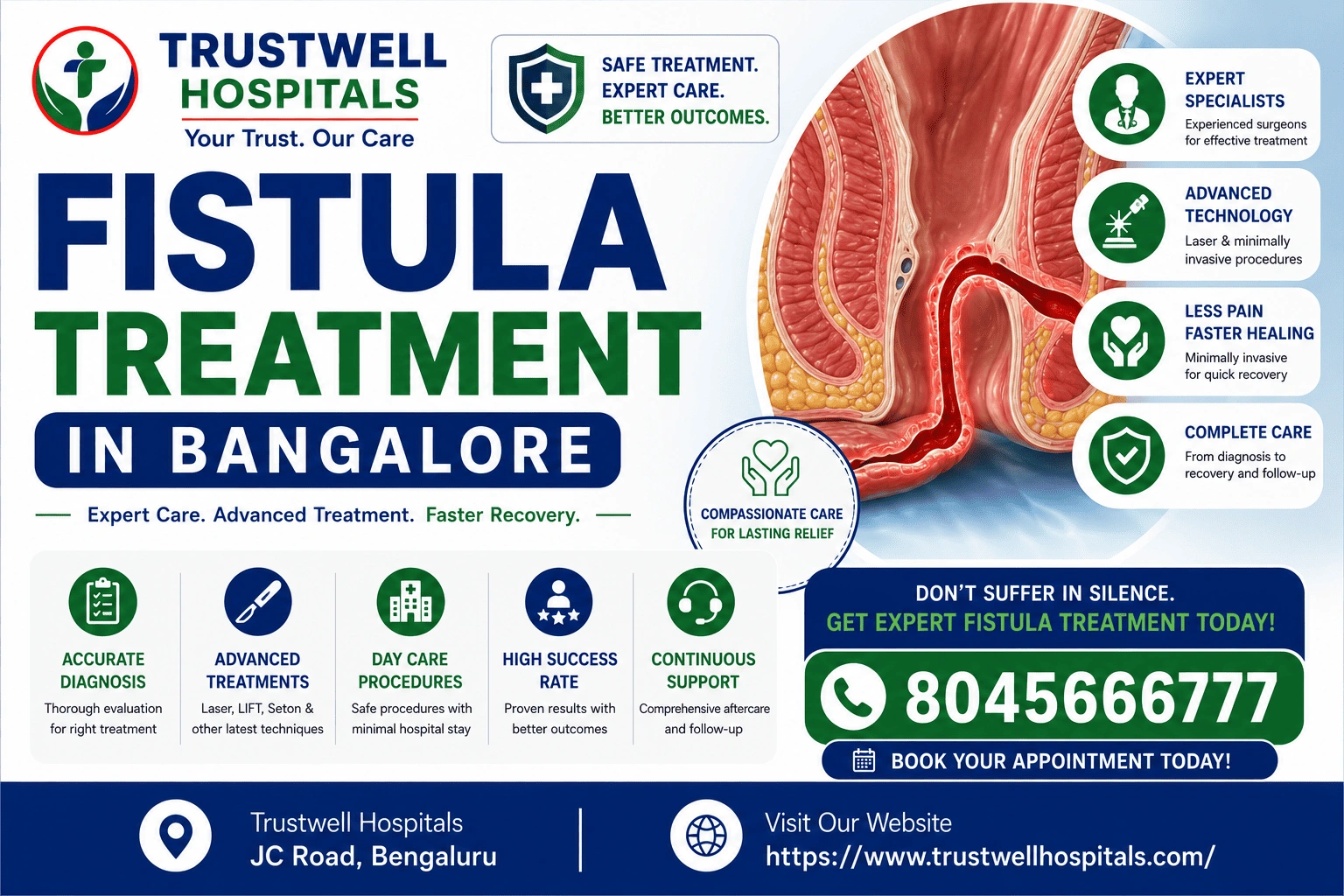 Fistula Treatment in Bangalore