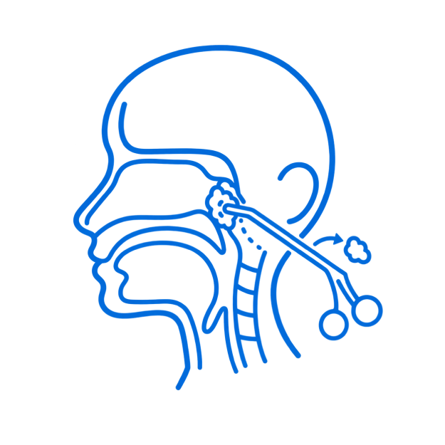 Adenoidectomy Surgery in Bangalore