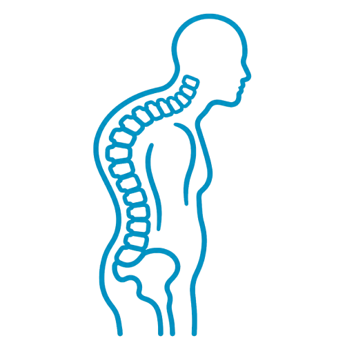 Kyphosis Treatment in Bangalore